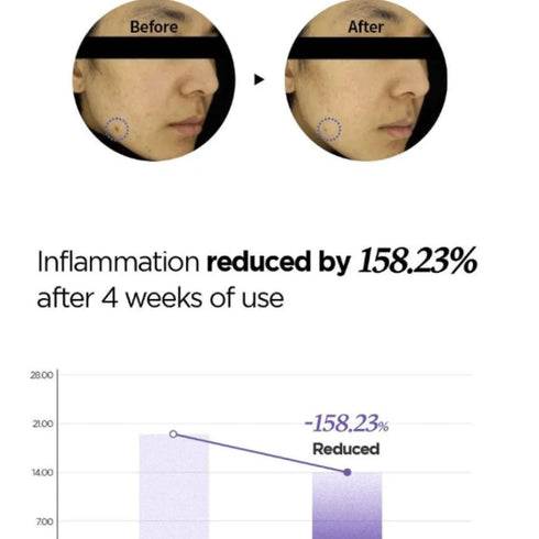 Patch per spot Newpair cipolla SKINFIT
